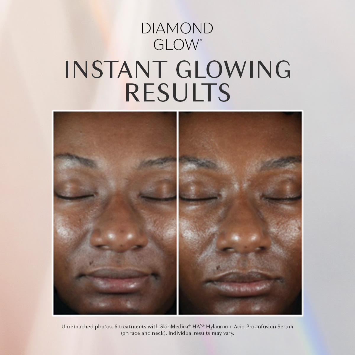 middle aged woman before and after a diamondglow facial